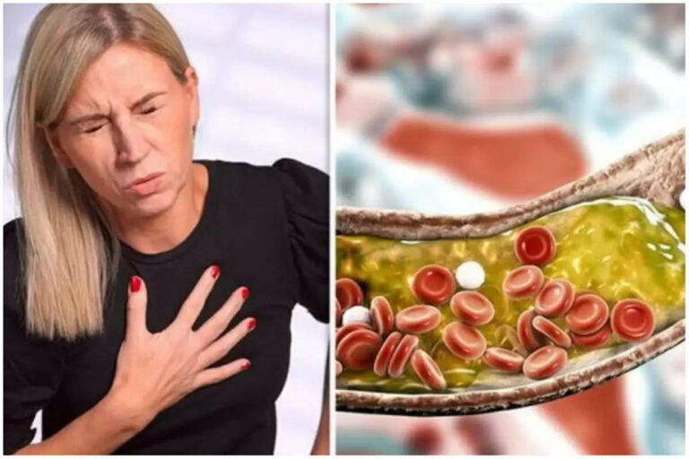 Cholesterol लेवल कम करेंगी ये 5 टिप्स, प्रकृति से जुड़ी आदतें आपको देंगी राहत