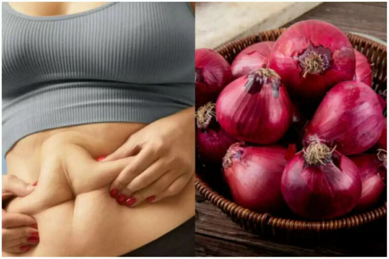 Weight Loss: वजन घटाने में बहुत फायदेमंद है प्याज, ऐसे खाएंगे तो मोटापा कम होगा