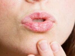 Lips Care Tips in Winters
