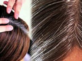 White Hair Problem Solution