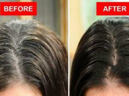 White Hair Solution