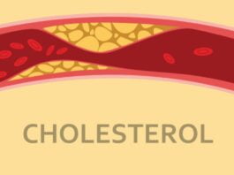 Cholesterol