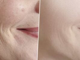 Home Remedies For Skin Tighten