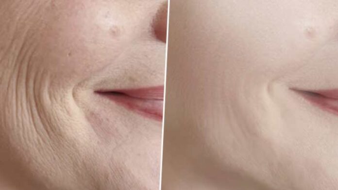 Home Remedies For Skin Tighten