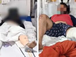 kanpur-due-to-a-money-dispute-a-girl-and-her-friend-were-thrown-from-a-moving-car-their-legs-were-broken-after-being-run-over-case-registered