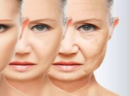 Fast Aging problem