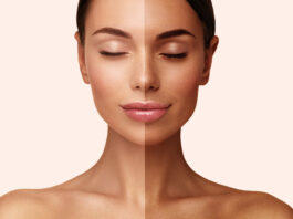 Skin Care Tips: Cure sun tan in summer with home remedies, follow these tips