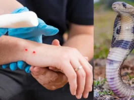 Snake venom bite treatment