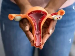 Cervical Cancer
