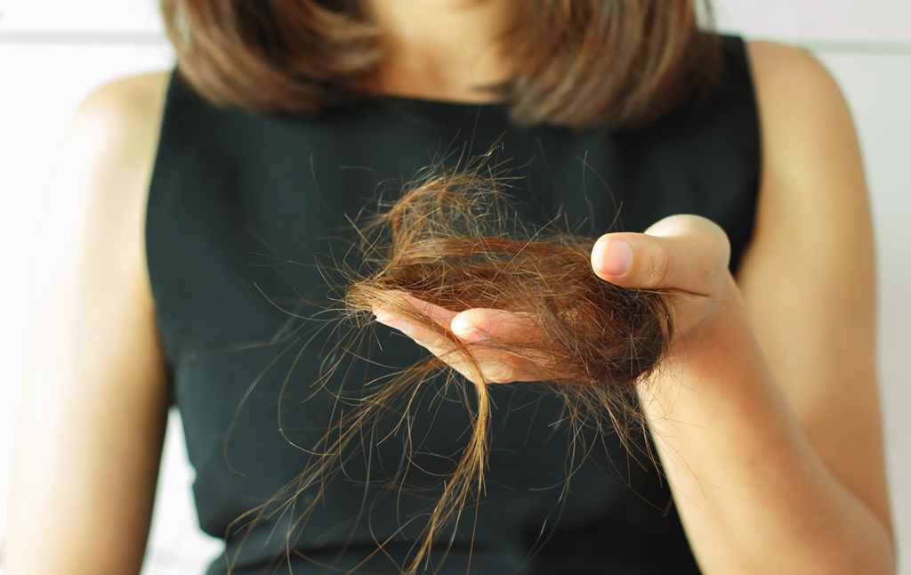 hair-fall_663011809-1
