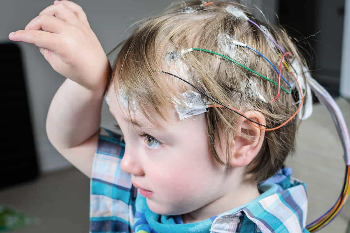 Functional Seizures in Children